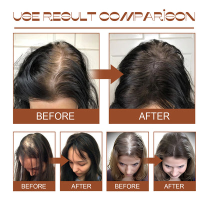 Batana Natural Hair Growth Oil
